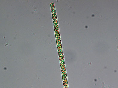 cylindrospermopsis