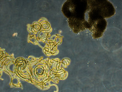 anabaena and microcystis