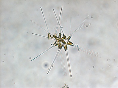 asterionellopsis