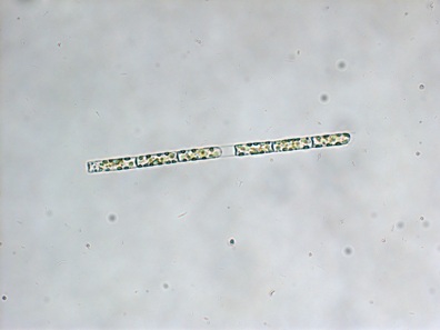 leptocylindrus