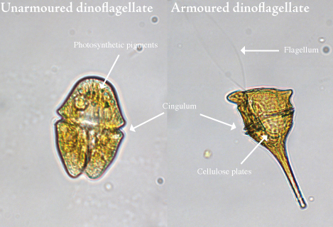 diatoms under microscope labeled