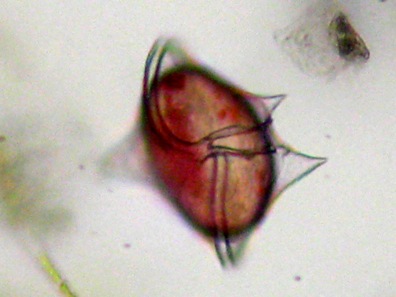 protoperidinium