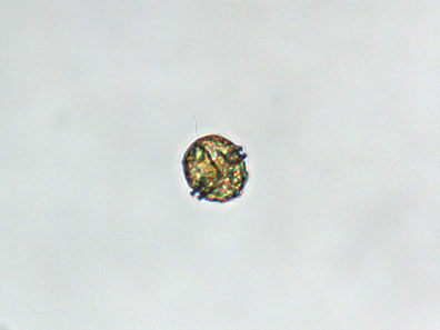 protoceratium